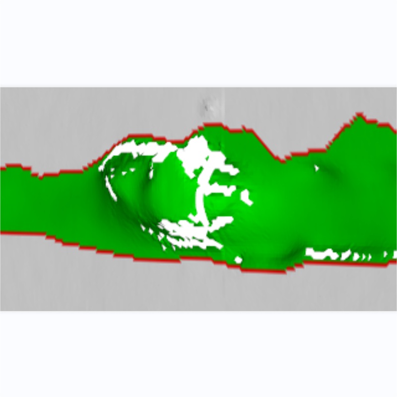 焊縫缺陷檢測系統——焊接質量的智能衛士